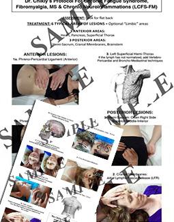 Lymph Chronic Fatigue Syndrome Posters (set of 2) - Ledger Size (LCFSP) Lymph Chronic Fatigue Syndrome Posters (set of 2) - Ledger Size (LCFSP)