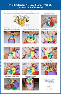 Intra-Oral Hands Position Poster From Fluid Articular Release Lower (FAR-L)